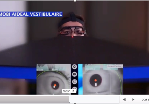 Vertiges et vision et motricité binoculaire